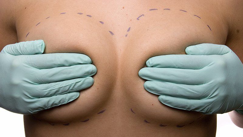 chirurgie-mammaire