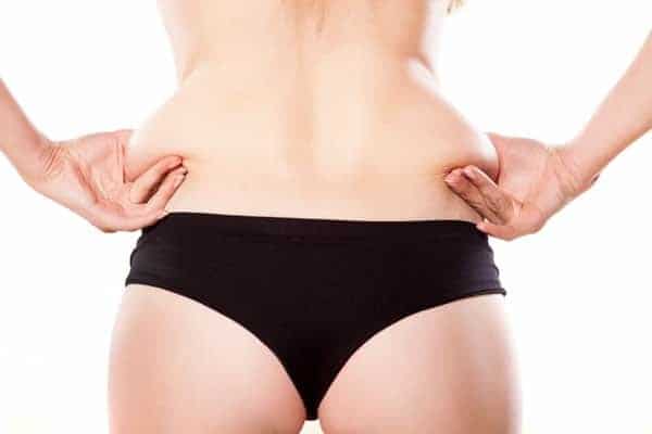 liposuccion des hanches