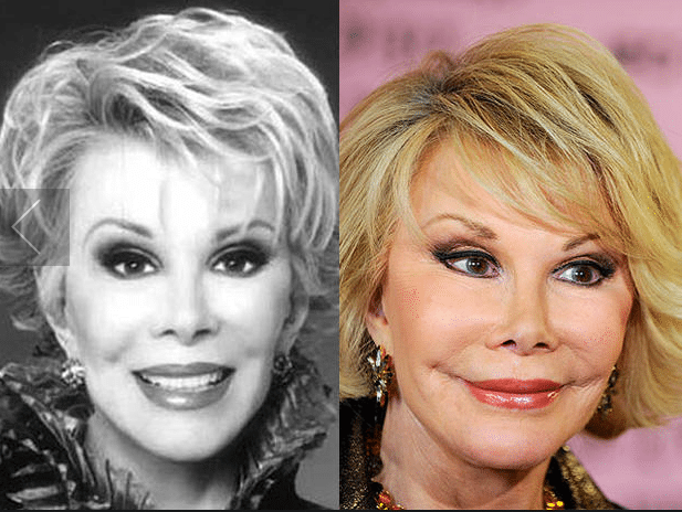 lifting raté Joan Rivers
