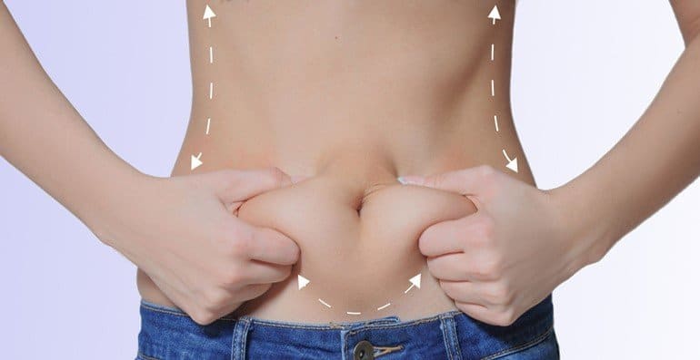 ventre mou abdominoplastie