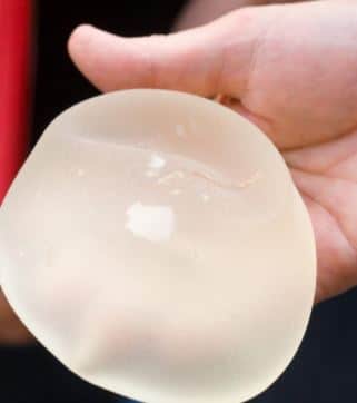 Implant alternatif