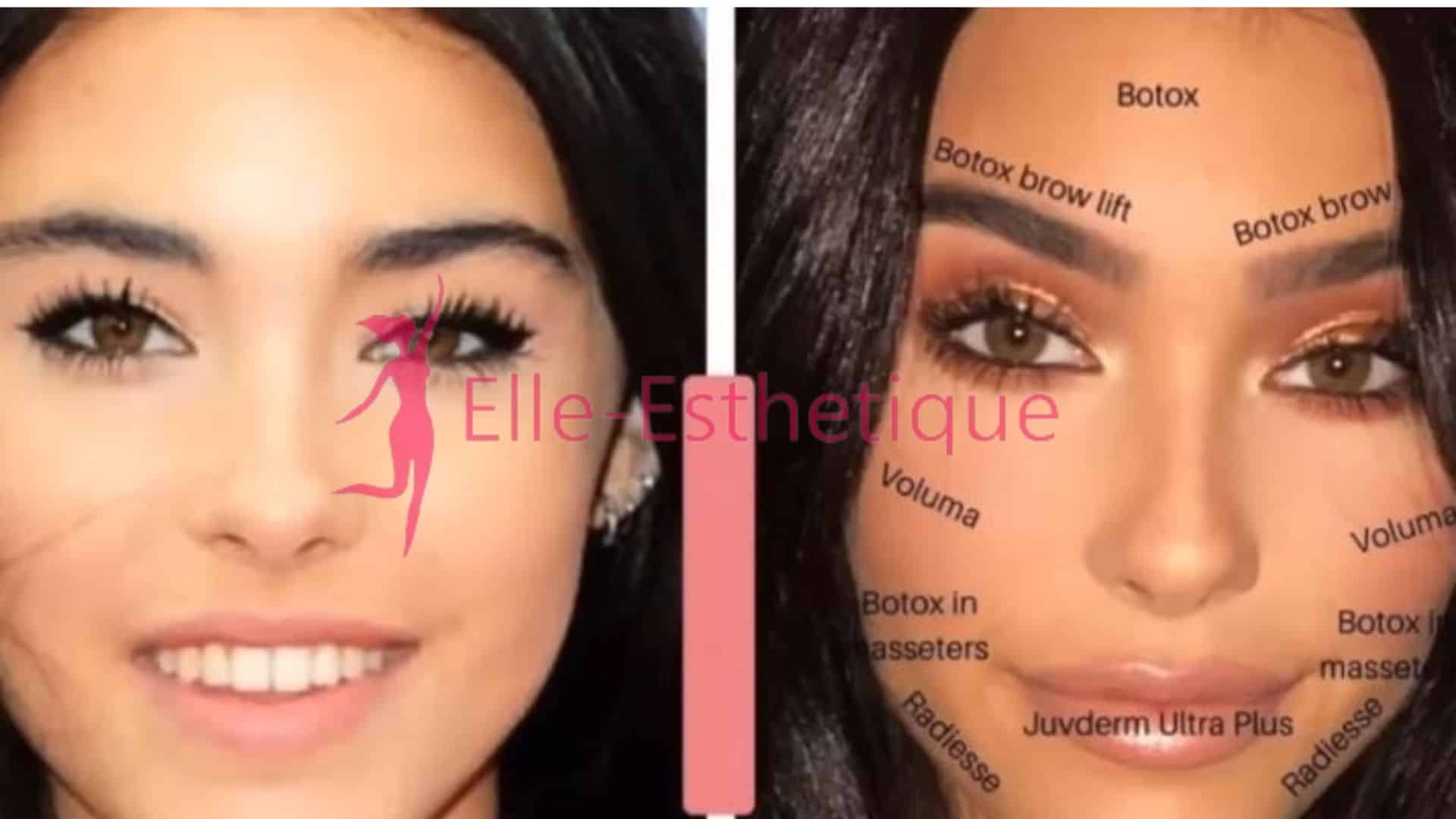 Chirurgie Esthétique de Madison Beer : Vrai ou Faux ?