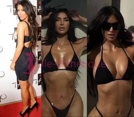 Kim Kardashian apres la chirurgie de la silhouette un changement radical